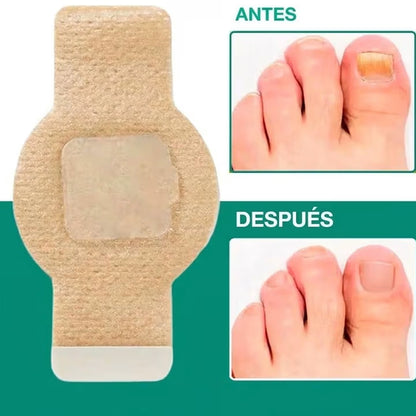 Mejora el aspecto de uñas dañadas mientras duermes — sin cremas ni tratamientos agresivos