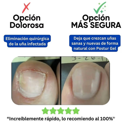 Mejora el aspecto de uñas dañadas mientras duermes — sin cremas ni tratamientos agresivos