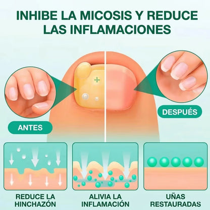 Mejora el aspecto de uñas dañadas mientras duermes — sin cremas ni tratamientos agresivos