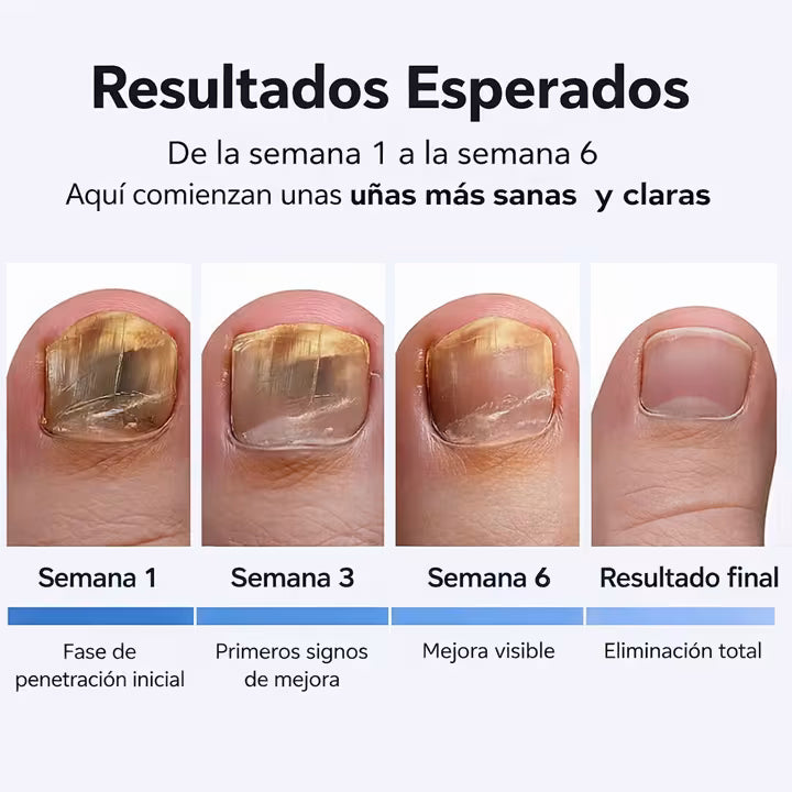 Mejora el aspecto de uñas dañadas mientras duermes — sin cremas ni tratamientos agresivos