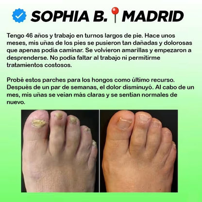 Mejora el aspecto de uñas dañadas mientras duermes — sin cremas ni tratamientos agresivos